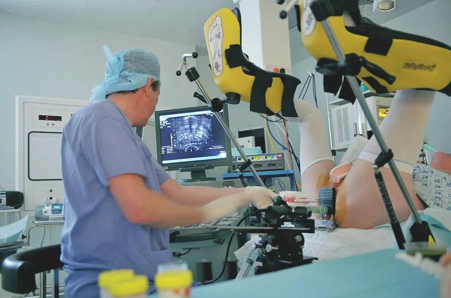 Tratamento de Próstata